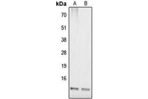 Western blot analysis of COX17 expression in IMR32 (A), HepG2 (B) whole cell lysates. (COX17 antibody  (N-Term))