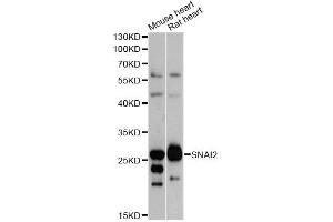 Western blot analysis of extracts of various cell lines, using SNAI2 antibody (ABIN5970416) at 1/1000 dilution. (SLUG antibody)