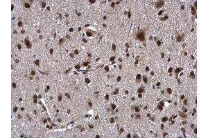 IHC-P Image ZNF346 antibody [N1C3] detects ZNF346 protein at cytoplasm and nucleus in rat brain by immunohistochemical analysis. (ZNF346 antibody)