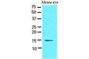 The extracts of mouse eye (30 ug) were resolved by SDS-PAGE, transferred to nitrocellulose membrane and probed with anti-human CRABP1 (1:500). (CRABP1 antibody  (AA 1-137))