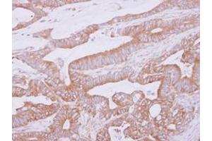 Image no. 1 for anti-THUMP Domain Containing 2 (THUMPD2) (AA 246-491) antibody (ABIN1501385) (THUMPD2 antibody  (AA 246-491))