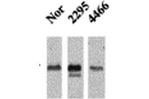 Western Blot analysis of Mouse Ventricle lysates showing detection of CaMKII protein using Mouse Anti-CaMKII Monoclonal Antibody, Clone 22B1 . (CAMKII gamma antibody  (PE))