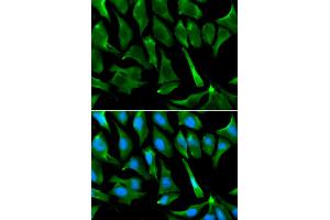 Immunofluorescence analysis of A549 cells using BRCA1 antibody. (BRCA1 antibody)