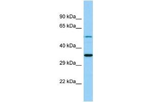 Western Blotting (WB) image for anti-Membrane Bound O-Acyltransferase Domain Containing 4 (MBOAT4) (C-Term) antibody (ABIN2444668) (MBOAT4 antibody  (C-Term))