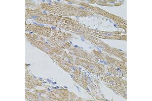 Immunohistochemistry of paraffin-embedded mouse heart using TRP antibody (ABIN6133559, ABIN6149565, ABIN6149567 and ABIN6224668) at dilution of 1:100 (40x lens). (TRPA1 antibody  (AA 850-950))