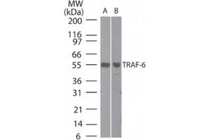 Western Blotting (WB) image for anti-TNF Receptor-Associated Factor 6 (TRAF6) (AA 436-449) antibody (ABIN208879) (TRAF6 antibody  (AA 436-449))