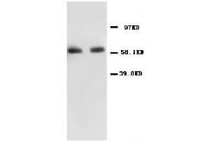 Anti-NF-kB p65 antibody, Western blottingAll lanes: Anti NF-kB p65  at 0. (NF-kB p65 antibody  (N-Term))