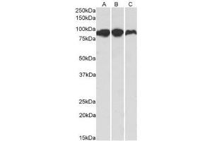 AP21267PU-N ACO2 Antibody staining of Human (A), Mouse (B) and Rat (C) Adipose lysates at 0. (ACO2 antibody  (Internal Region))