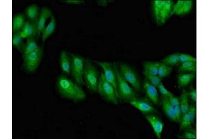 Immunofluorescent analysis of Hela cells using ABIN7167078 at dilution of 1:100 and Alexa Fluor 488-congugated AffiniPure Goat Anti-Rabbit IgG(H+L) (RALBP1 antibody  (AA 6-105))