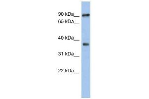 RSPH10B antibody used at 1 ug/ml to detect target protein. (RSPH10B antibody)