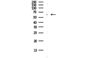 anti-Forkhead Box J2 (FOXJ2) antibody