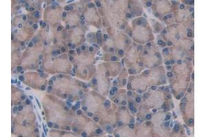 DAB staining on IHC-P; Samples: Rat Pancreas Tissue (GBA antibody  (AA 248-508))
