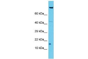 Host: Rabbit Target Name: NDUFA12 Sample Type: Jurkat Whole Cell lysates Antibody Dilution: 1. (NDUFA12 antibody  (N-Term))