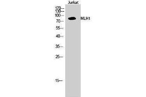 Western Blotting (WB) image for anti-MutL Homolog 1 (MLH1) (Internal Region) antibody (ABIN3185582) (MLH1 antibody  (Internal Region))