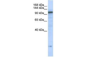 ATP2A2 antibody used at 1 ug/ml to detect target protein.