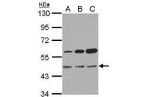 Image no. 2 for anti-3-Oxoacyl-ACP Synthase, Mitochondrial (OXSM) (AA 1-236) antibody (ABIN1501900) (OXSM antibody  (AA 1-236))