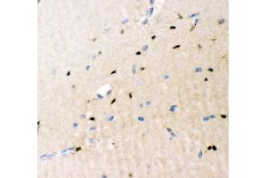 IHC analysis of Crk p38 using anti-Crk p38 antibody (ABIN3042758). (Crk antibody  (AA 2-246))