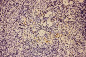 Anti-GM-CSF Picoband antibody,  IHC(P): Mouse Spleen Tissue (GM-CSF antibody  (AA 18-141))