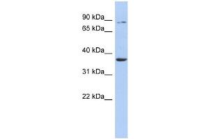 HS3ST1 antibody used at 1 ug/ml to detect target protein. (HS3ST1 antibody)