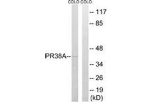 Western blot analysis of extracts from COLO cells, using PRPF38A Antibody. (PRPF38A antibody  (AA 104-153))