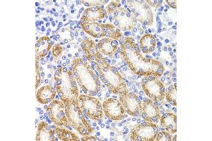 Immunohistochemistry of paraffin-embedded rat kidney using HMGCL antibody. (HMGCL antibody)