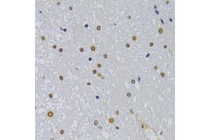 Immunohistochemistry of paraffin-embedded rat spinal cord using HNRNPA1 Antibody (ABIN5975570) at dilution of 1/100 (40x lens). (HNRNPA1 antibody)