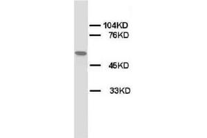 Western blot on Rat skeletal muscle lysis using AP23320PU-N CHRNA1 antibody. (CHRNA1 antibody  (N-Term, Subunit alpha))