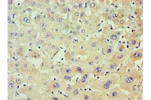 Immunohistochemistry of paraffin-embedded human liver tissue using ABIN7150482 at dilution of 1:100 (POLR1D antibody  (AA 1-133))