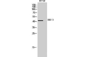 Western Blotting (WB) image for anti-Sphingosine-1-Phosphate Receptor 3 (S1PR3) (Internal Region) antibody (ABIN3174867) (S1PR3 antibody  (Internal Region))