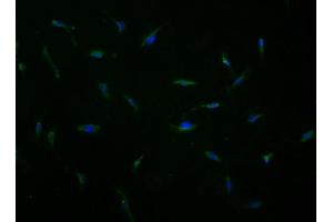 Immunofluorescence staining of U251 cells with ABIN7167254 at 1:100, counter-stained with DAPI. (RAB23 antibody  (AA 18-234))