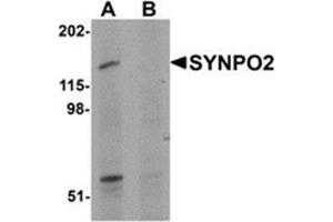Western blot analysis of SYNPO2 in human skeletal muscle tissue lysate with SYNPO2 antibody at 1 μg/ml in (A) the absence and (B) the presence of blocking peptide. (SYNPO2 antibody  (N-Term))