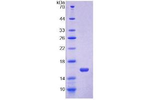 SDS-PAGE (SDS) image for Occludin (OCLN) (AA 17-107) protein (His tag) (ABIN1171066)