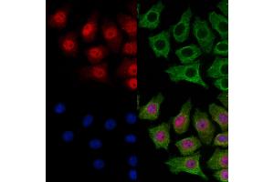 ABIN7094896 and ABIN7098949 staining HepG2 cells by IF/ICC. (SMC5 antibody  (C-Term))