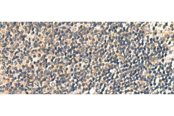 CNST antibody
