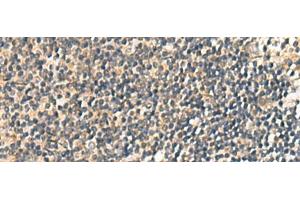 Immunohistochemistry of paraffin-embedded Human tonsil tissue using CNST Polyclonal Antibody at dilution of 1:60(x200) (CNST antibody)