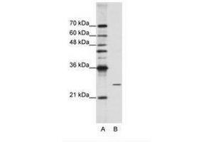 Image no. 2 for anti-Processing of Precursor 4, Ribonuclease P/MRP Subunit (POP4) (C-Term) antibody (ABIN202077) (RPP29 antibody  (C-Term))