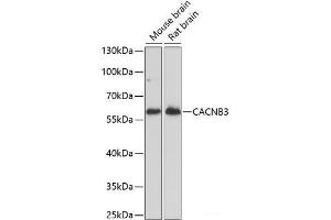 CACNB3 antibody