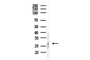 anti-Protein-L-Isoaspartate (D-Aspartate) O-Methyltransferase (PCMT1) (Internal Region) antibody