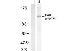 Western blot analysis of extract from 3T3 cell, using FAK (phospho-Tyr397) antibody (E011215, Lane 1 and 2). (FAK antibody  (pTyr397))