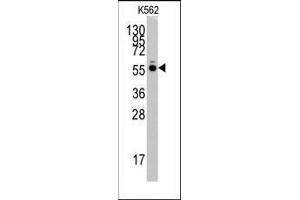 Western blot analysis of anti-HARS Pab in K562 cell line lysates (35ug/lane). (HARS1/Jo-1 antibody  (N-Term))