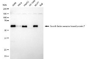 Western blotting analysis using growth factor receptor bound protein 7 antibody (ABIN7798808). (Recombinant GRB7 antibody)