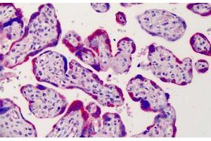 Human Placenta: Formalin-Fixed, Paraffin-Embedded (FFPE) (ADAM12 antibody  (AA 2-14))