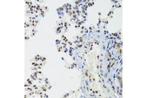 Immunohistochemistry of paraffin-embedded mouse lung using BAZ1B antibody.
