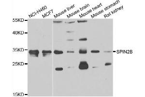 Western blot analysis of extracts of various cell lines, using SPIN2B antibody. (Spindlin 2B antibody)