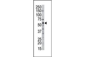 The anti-SPTLC2 Pab (ABIN389107 and ABIN2839297) is used in Western blot to detect SPTLC2 in mouse liver tissue lysate. (Serine Palmitoyltransferase (AA 531-562), (C-Term) antibody)