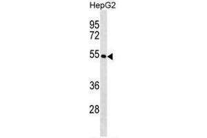 KRT26 Antibody (N-term) western blot analysis in HepG2 cell line lysates (35µg/lane).