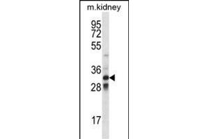 TLX1 Antibody (Center) (ABIN656421 and ABIN2845712) western blot analysis in mouse kidney tissue lysates (35 μg/lane). (TLX1 antibody  (AA 163-191))