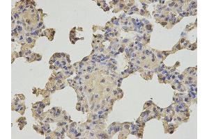 Immunohistochemistry (IHC) image for anti-Nudix (Nucleoside Diphosphate Linked Moiety X)-Type Motif 1 (NUDT1) antibody (ABIN1876662)