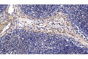 Immunohistochemistry (IHC) image for anti-Fibromodulin (FMOD) (AA 19-376) antibody (ABIN7433693)