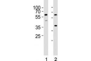 Western blot analysis of lysate from 1) HT-29 and 2) K562 cell lines using RIPK3 antibody at 1:1000. (RIPK3 antibody  (AA 61-91))